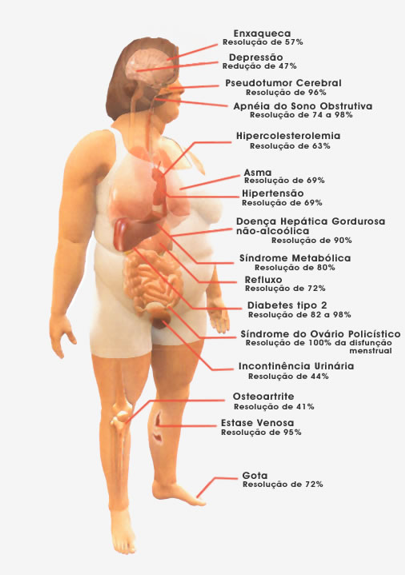 Cirurgia da Obesidade – Dra Fabiana Franca